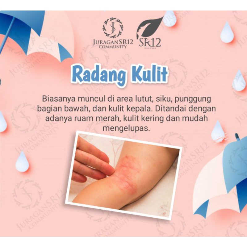 Obat Gatal Gatal Bayi - Ruam Popok - Bruntusan - Biang Keringat 100% Alami