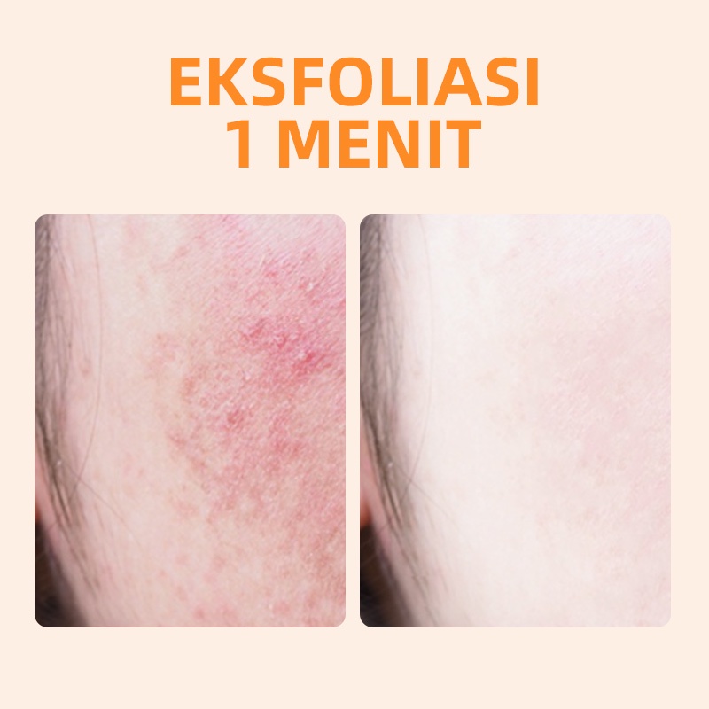 GMEELAN SET 1 Minute Exfoliating Gel 50g + Pemutih Wajah Lazy Cream 30g + 24k Gold Body Whitening Soap 100g