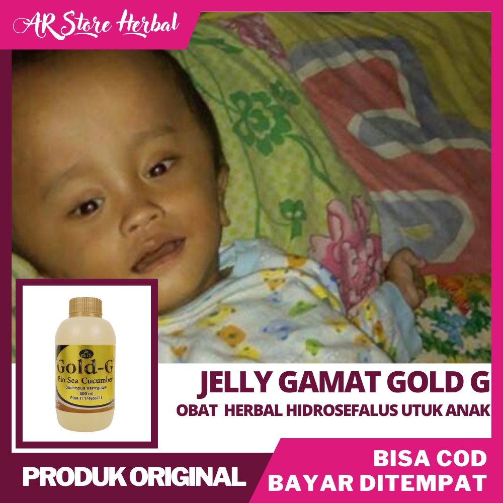 Jelly Gamat Gold-G Obat Herbal Hidrosefalus - Hydrocephalus - Air Di Dalam Otak - Cairan serebrospin