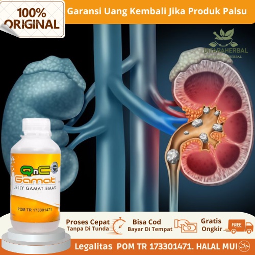 Obat Ginjal Bocor, Obat Nyeri Ginjal, Obat Kebocoran Ginjal, Obat Sindrom Nefrotik, Obat Ginjal Boco