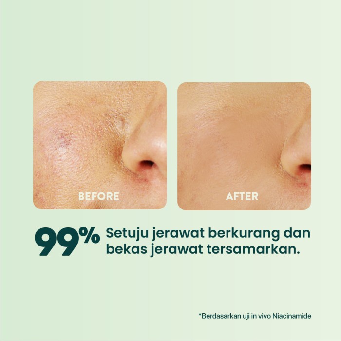 NPURE Centella Asiatica Sheet Mask