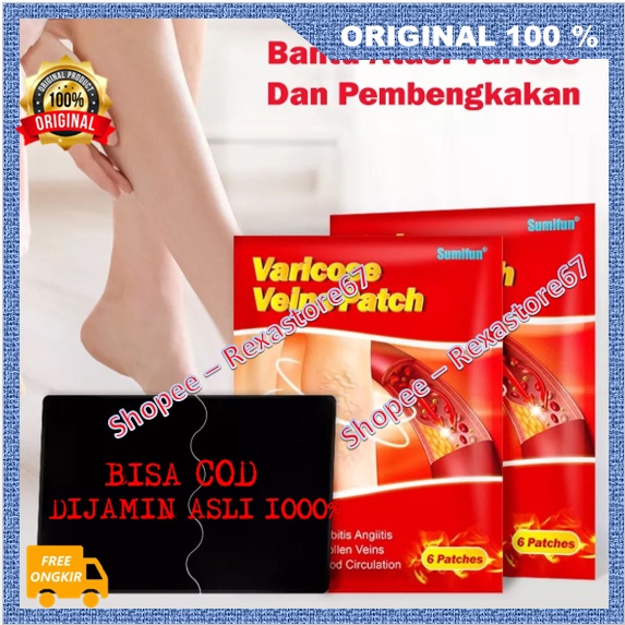 Varises Patch Koyo Herbal Penghilang Varises Vaskulitis Parises Urat Menjol Ampuh ASLI
