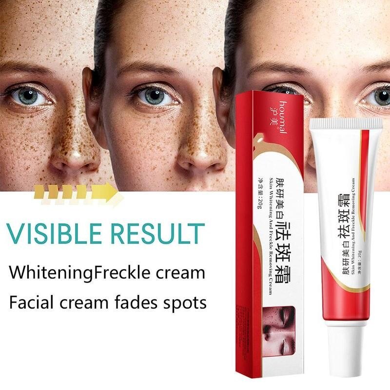 BEOTUA Whitening Freckle Cream Niacinamide Melasm Cream 20Gr Untuk Krim Pelembab Wajah Pemutih Penghilang Flek Hitam Bintik Hitam Mencerahkan kulit