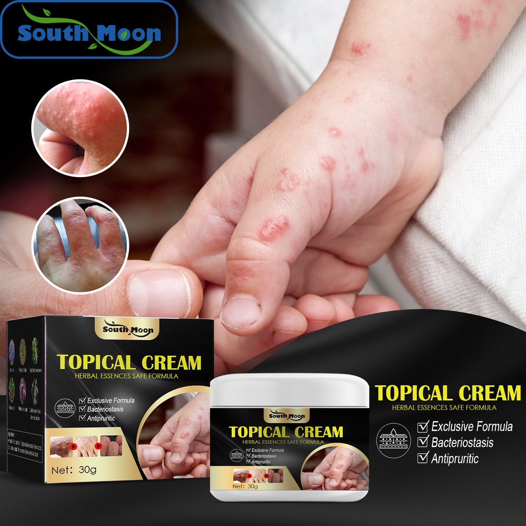 krim anti gatal gigitan nyamuk, krim anti gatal , gigitan nyamuk dan serangga , mengurangi pembengkakan dan nyeri, gatal, alergi kulit, anti bakteri anti gatal, cepat mengatasi gatal, mengatasi gatal area pribadi, krim anti bakteri