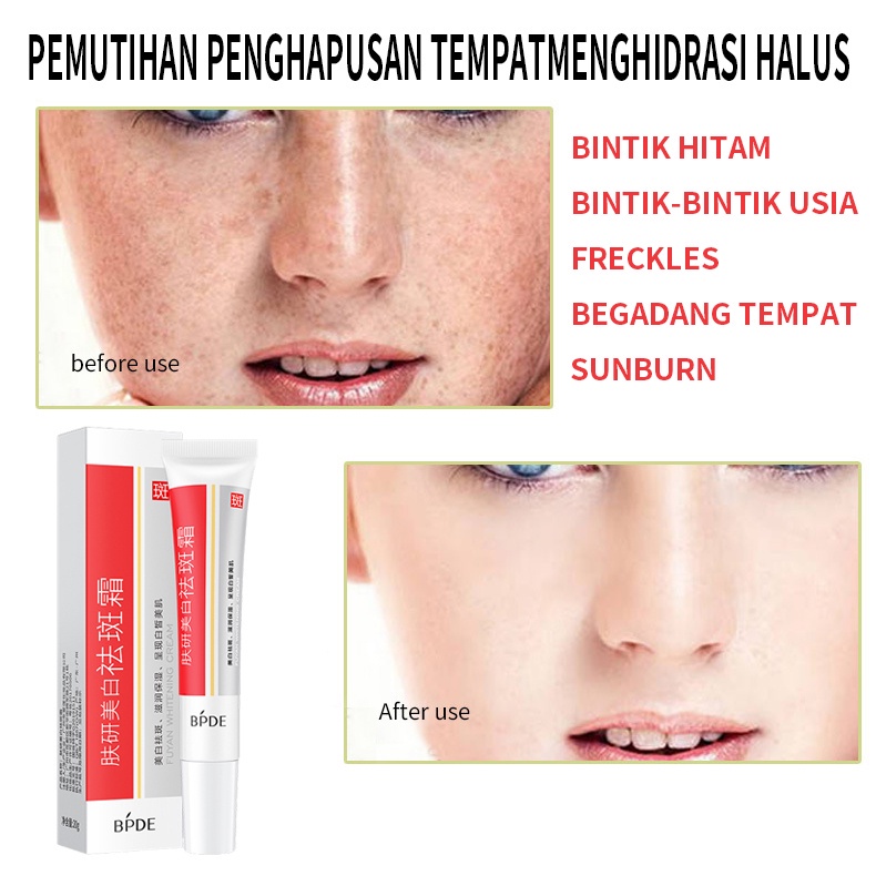 Flek Bintik Hitam Cream Flek Wajah Krim Untuk Menghilangkan Flek Bintik Hitam Wajah COD