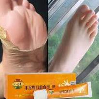 ✯Produk Keren▼ Salep Kaki Pecah-pecah Tangan Krim Tumit Pecah-pecah Mengupas Kaki dan Tangan Perbaik