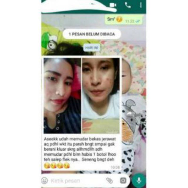 BISA COD  Paket Normal Glowing Paket Glowing Terlarir Termurah Ampuh Memutihkan Wajah Extra Cepat Paket Zayora Isi 4