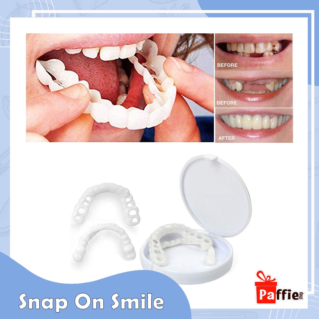 Snap On Smile Veneer Instan Gigi Palsu Tiruan Kesehatan Mulut Mouth Ok