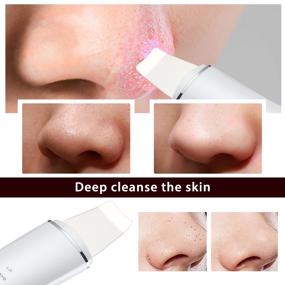 Ultrasonic Facial Scrubber Penghilang Komedo Komedo Penggosok Kulit Wajah Mild Supersonic Mar Remover Alat Perawatan Wajah