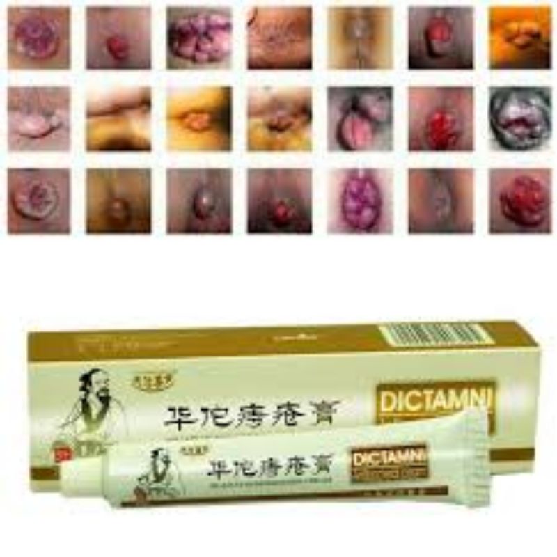 SALEP DICTAMNI HUATUO CREAM OBAT WASIR AMBIEN HERBAL CINA AMBEIAN AMBEYEN AMPUH CREAM ANAL ANUS