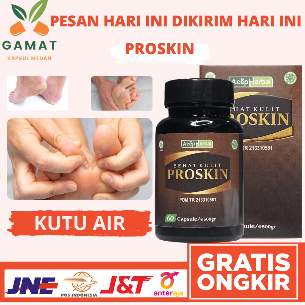 Obat Kutu Air Kuman Air di Sela Jari Panu Hapuran Kadas Kurap Eksim Psoriasis Alergi Kulit Gatal Sel