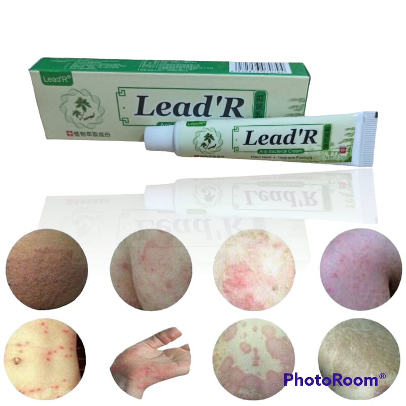Obat Gatal 100% Original Lead'R x Zudaifu Salep Gatal Salep Kulit Jamur Dermatitis Psoriasis Eksim Jamur Kurap Alergi Kulit Cream Obat Gatal