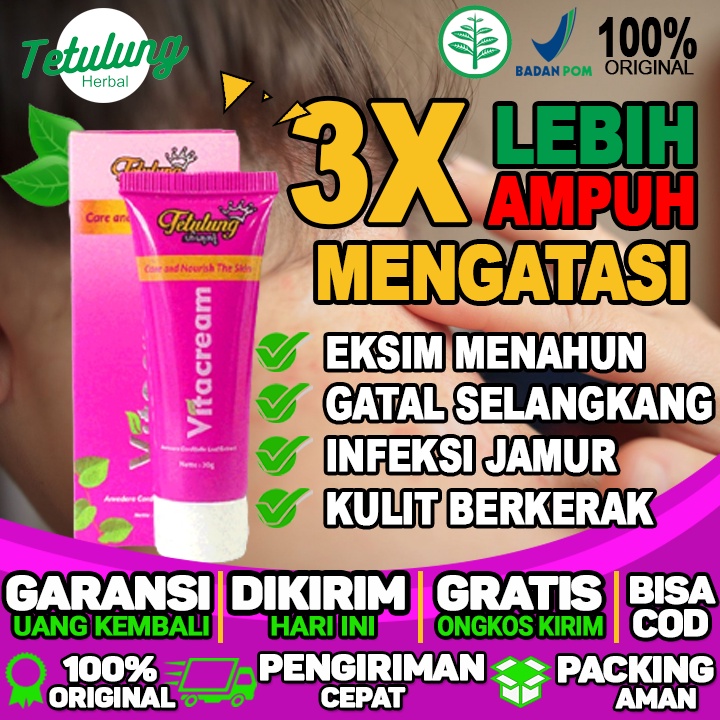 Obat Salep Gatal Vitacream Salep Paling Amouh Menghilangkan Gatal Dan Hitam Bekas Gatal