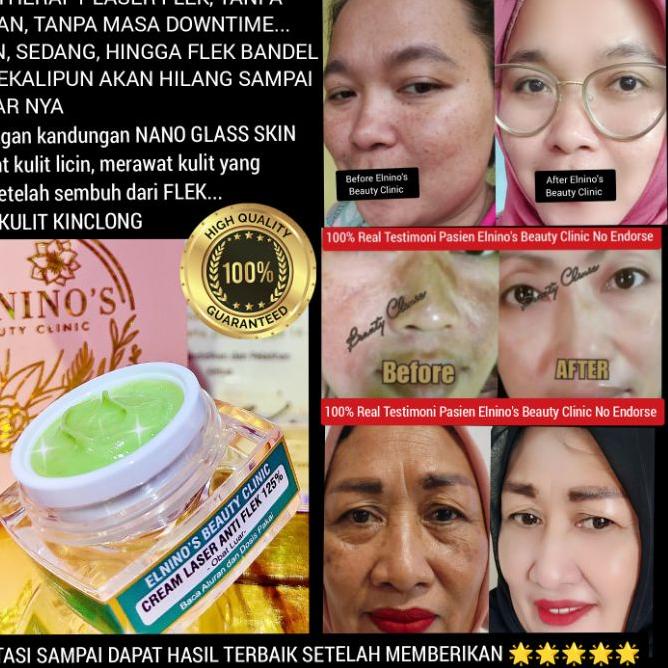 ֍ ELNINO'S CREAM LASER ANTI FLEK NANO GLASS SKIN 125% BEAUTY CLINIC ✮