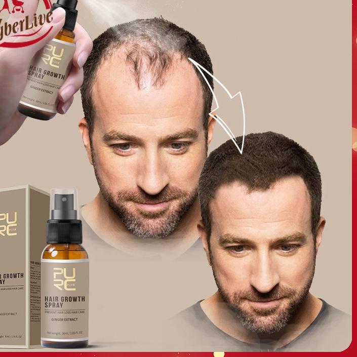 ➴ 20ml Hair Serum Penumbuh Rambut Prevent Hair Loss Hairen Hair Growth Serum Essence Oil ✤