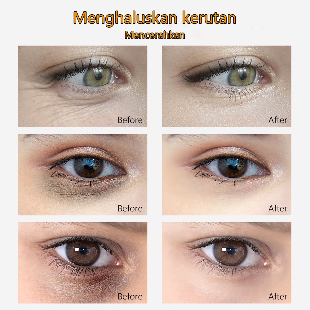 EYE SERUM KRIM MATA PENGHILANG KANTONG HITAM MATA MENGHILANGKAN KANTUNG MATA PANDA HITAM KERUTAN 40G Aman dan efektif