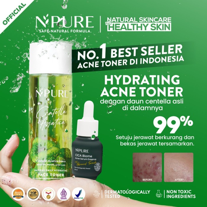 Npure Paket Face Toner 150ml + Serum Biome Cica Series (Acne Series)
