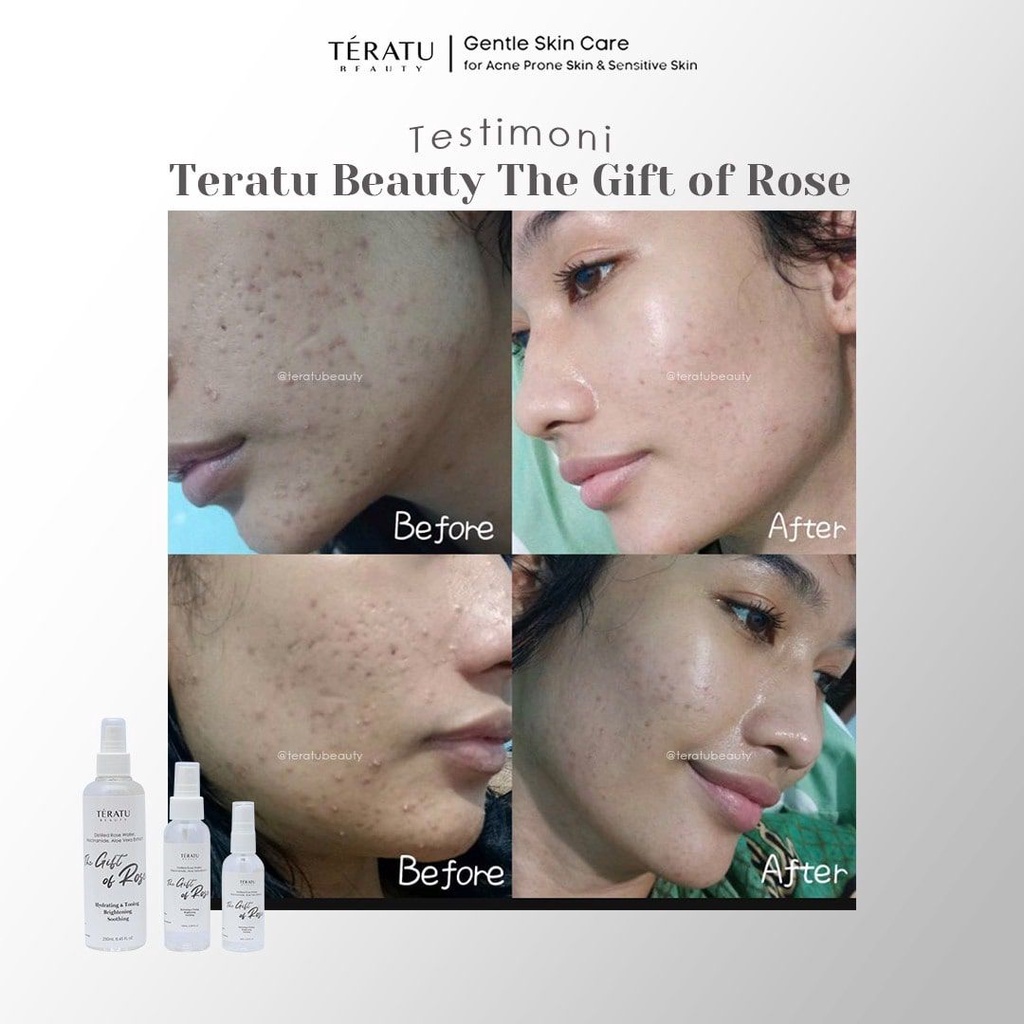 ⭐BAGUS⭐ TERATU BEAUTY The Gift Of Rose Soothing &amp; Brightening Toner Spray 250ml | 100ml | 60ml | Air Mawar