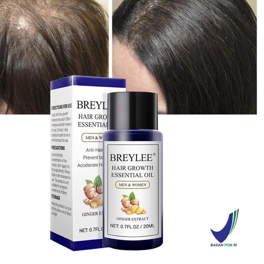 ◄ [] BREYLEE Hair Growth Essential Oil 20ml (Serum Penumbuh Rambut - Mencegah Kerontokan) ✱