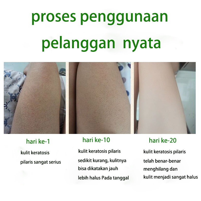 Body Scrub Body Bleaching Whitening Lulur Tubuh 250g Shea Butter Body Lulur Scrub Pemutih Badan dan Menghaluskan Kulit Eksfoliasi aman dan efektif