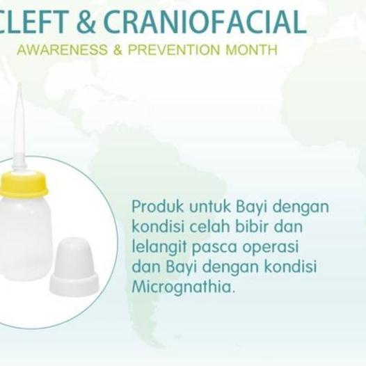 ✻ Botol Bibir Sumbing Pigeon Botol Pipet Bibir Sumbing Pigeon dot panjang bayi ➵