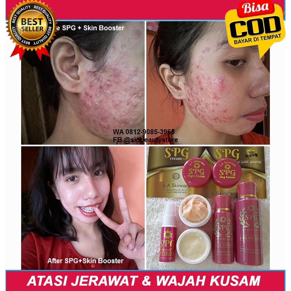 [MONEY BACK GUARANTEE] | Cream Wajah Ampuh Glowingkan Wajah, Pemutih Penghilang Jerawat & Flek, Crea