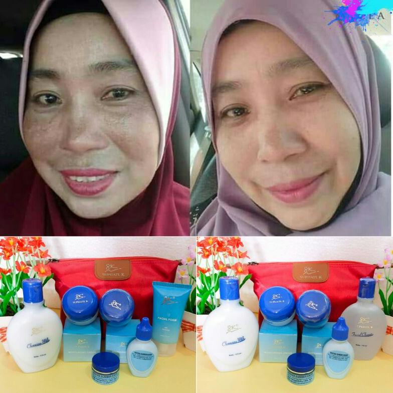 Paket pengusir Flek hitam Skincare Dr. Supijati