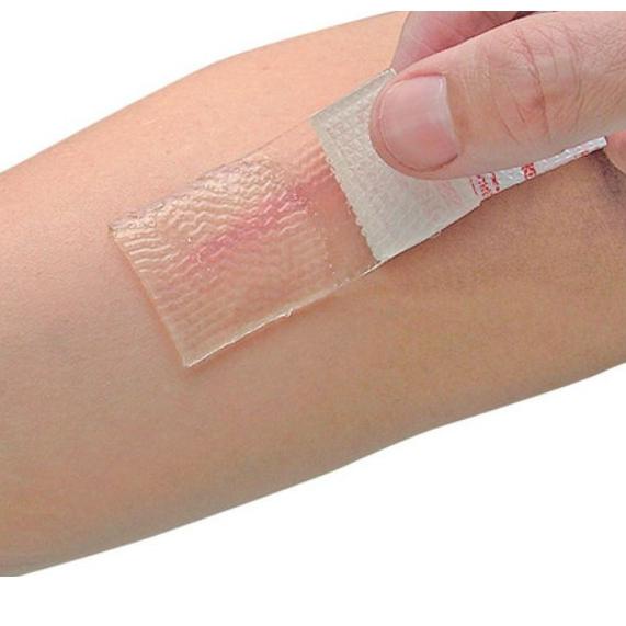 ➷ Cica-Care Silicone Gel untuk Keloid ➳