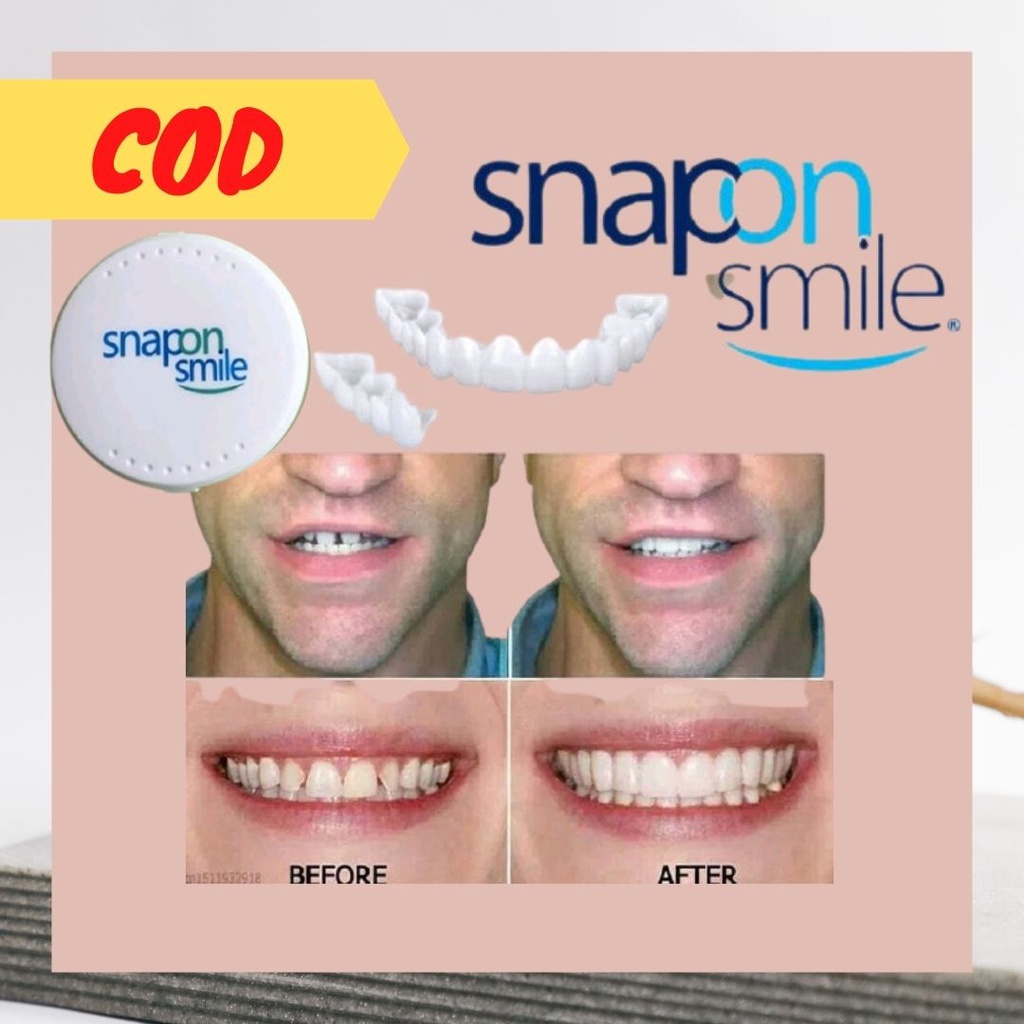 Halal COD Snap On Smile 100 % Venners Gigi Original 100% 1Set Atas dan Bawah Gigi Palsu Snapon Perfect Smile Premium