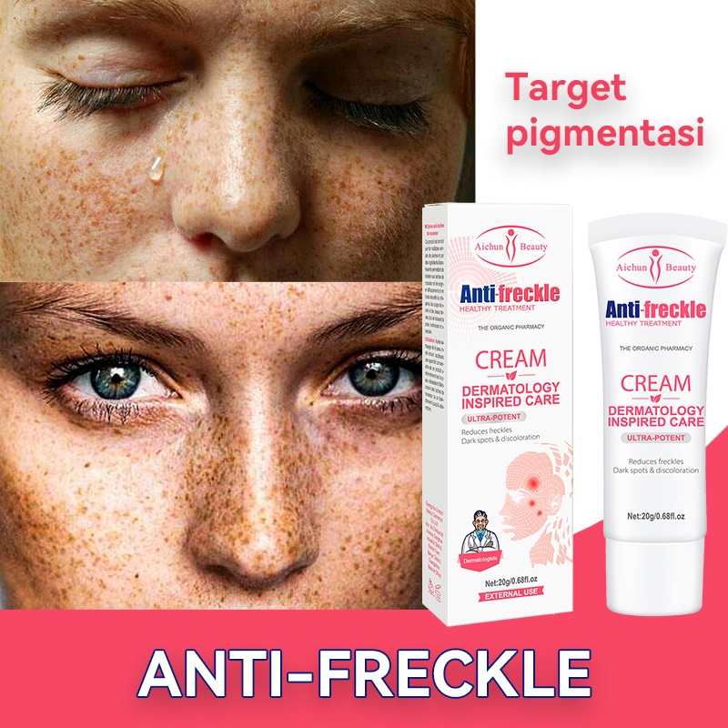Glowing Krim Krim bintik Penghilang flek hitam Salep Flek Hitam Menghilangkan melasma Bintik-bintik 