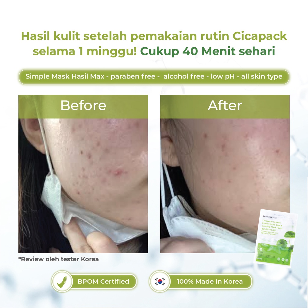 Easybeaute Cicapack Jeju Wild Centella Sheet Mask  - Penghilang Beruntus, Pencegah Jerawat Kemerahan