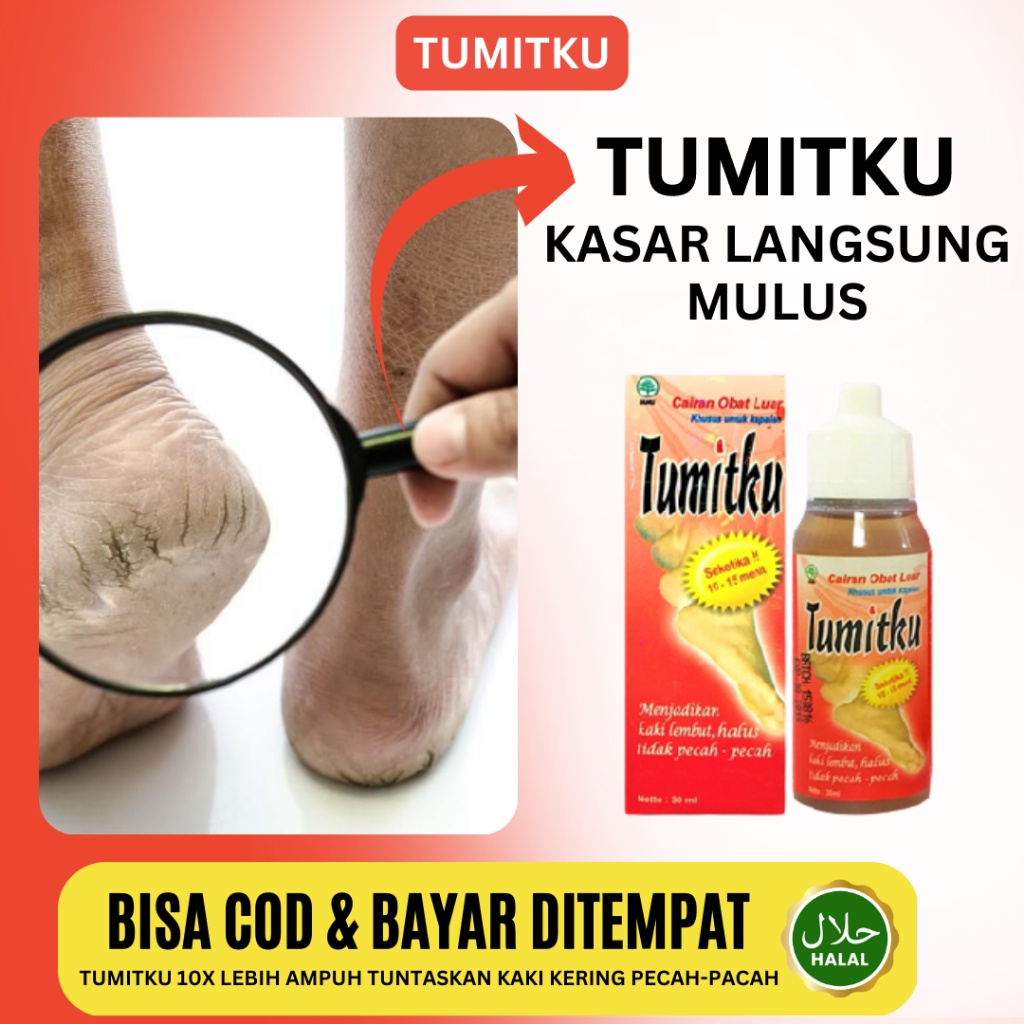 TUMITKU Obat Kaki Pecah Dan Kering Foot Cream Penghalus Tumit Kaki Cream Kaki Pecah-pecah Ampuh