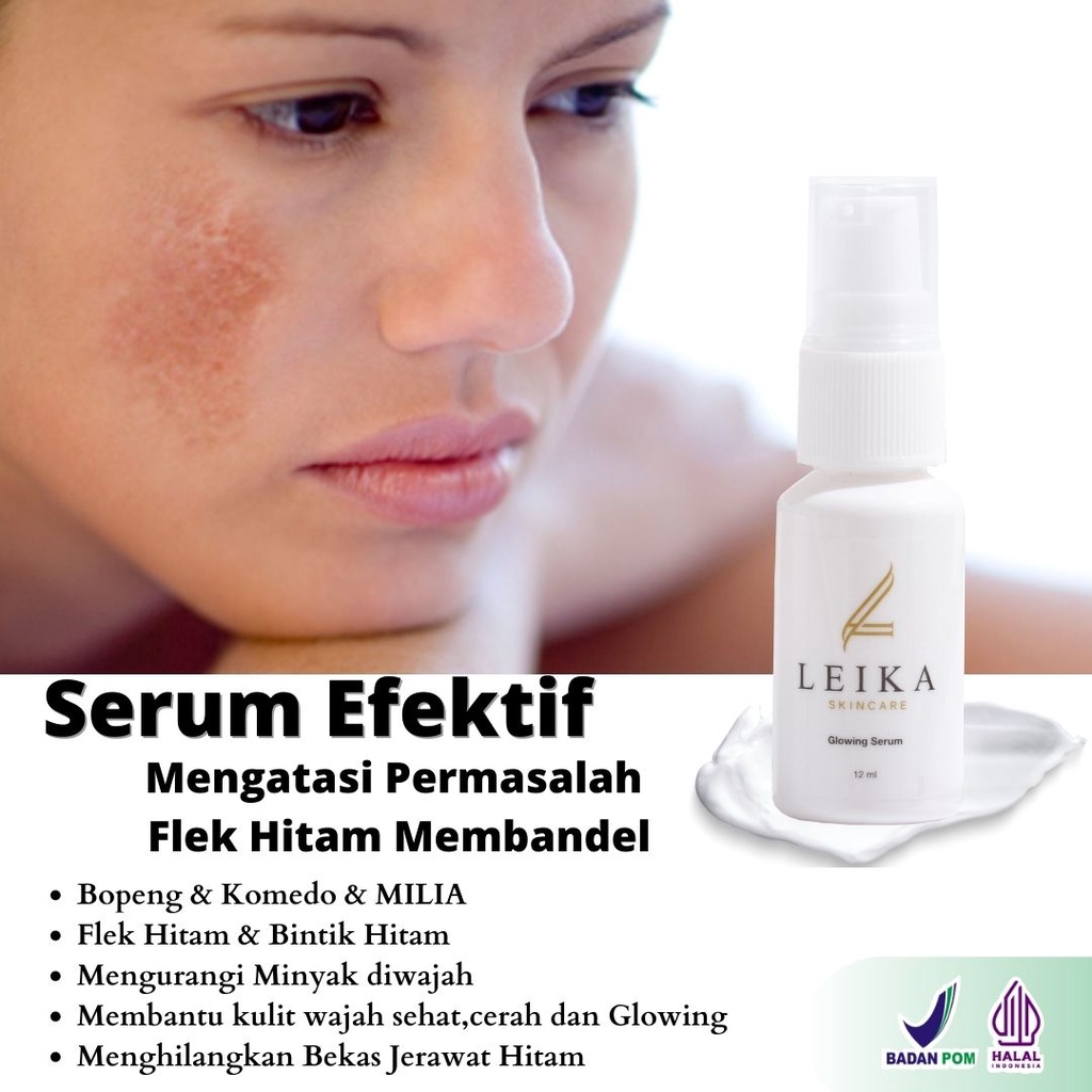 Serum penghilang flek hitam di wajah ampuh bpom serum penghilang flek hitam di wajah serum flek hita