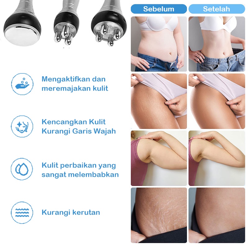 Mesin Pelangsing Rf Radio Frekuensi Slimming 3in1 dengan Ultrasound 40K - Alat Pijat Wajah dan Tubuh untuk Membakar Lemak dan Menghilangkan Kerut - Original dan Asli