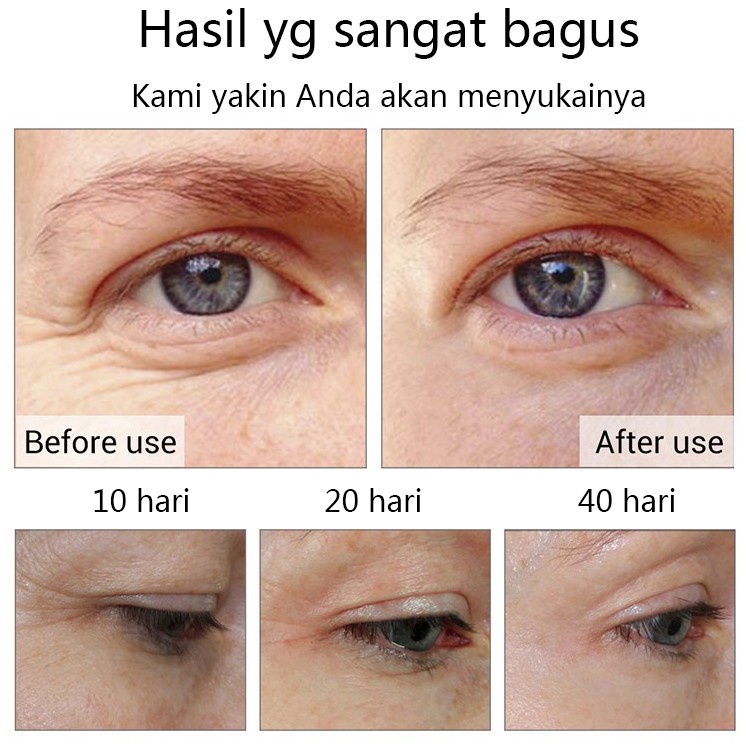 EYE SERUM KRIM MATA PENGHILANG KANTONG HITAM MATA MENGHILANGKAN KANTUNG MATA PANDA HITAM KERUTAN 40G Aman dan efektif