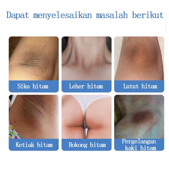 Krim Pemutih Pelembab Kulit krim pemutih ketiak Krim Pelembab /pribadi/ketiak/lutut/paha Pemutih seluruh tubuh Tersedia untuk ibu hamil body lotion pemutih