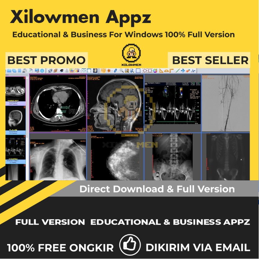 [Full Version] Sante DICOM Viewer 3D Pro Educational Business Lifetime Win OS