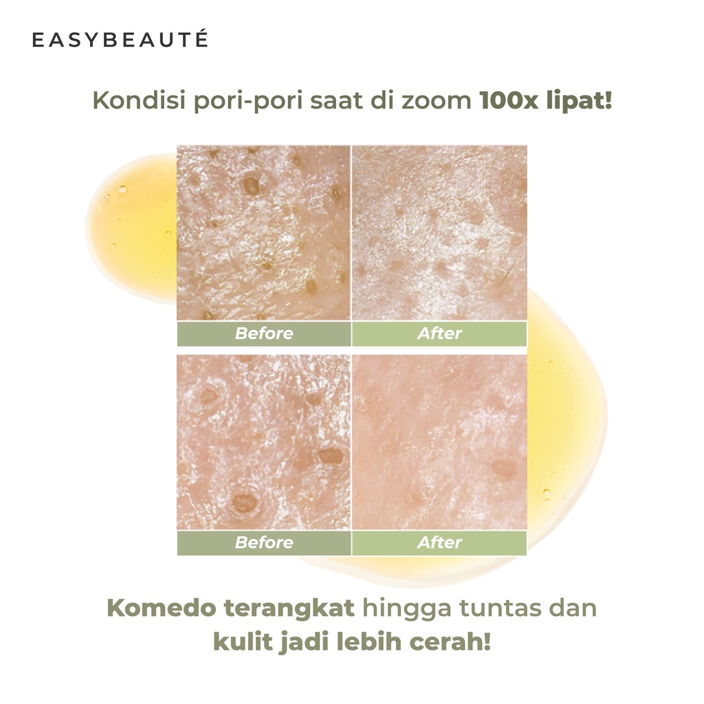 Easybeaute Kalapack Instant Brightening Sheet Mask Untuk Mencerahkan &amp; Memutihkan Kulit 28g