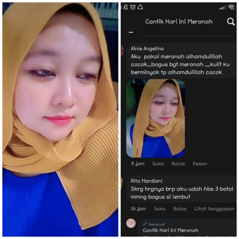 (NEW)SABUN JERAWAT, BERUNTUSAN, KOMEDO, WAJAH SENSITIVE ,WAJAH IRITASI AKIBAT GANTI GANTI SKINCARE ,FACIALWASH TERBARU