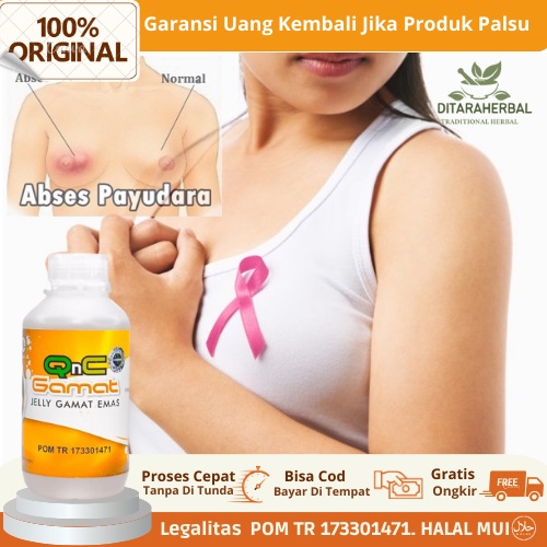 Obat Abses Payudara bernanah, Obat Payudara Bengkak, Obat Payudara Terasa Sakit, Obat Abses Payudara