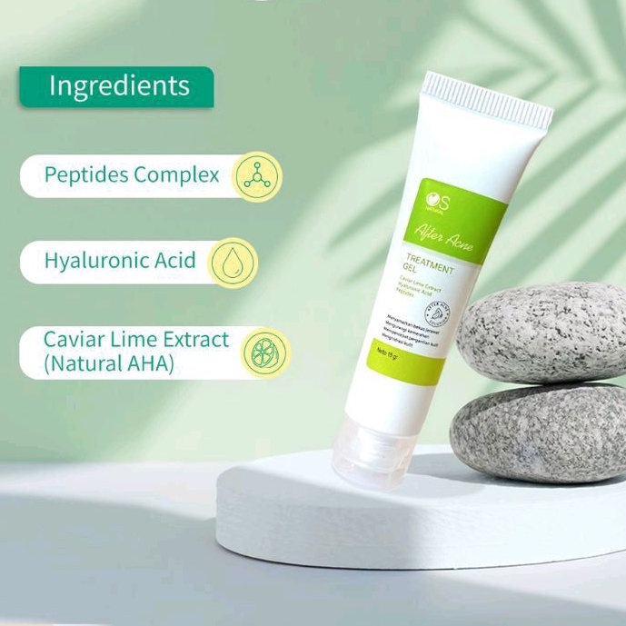 Larissa Acne After Treatment