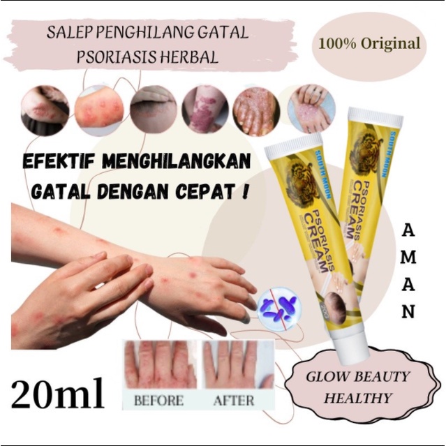 (Beli 2 Gratis 1) Salep gatal Salep kulit Krim perbaikan gatal kulit Krim psoriasis 20g Salep eksim 