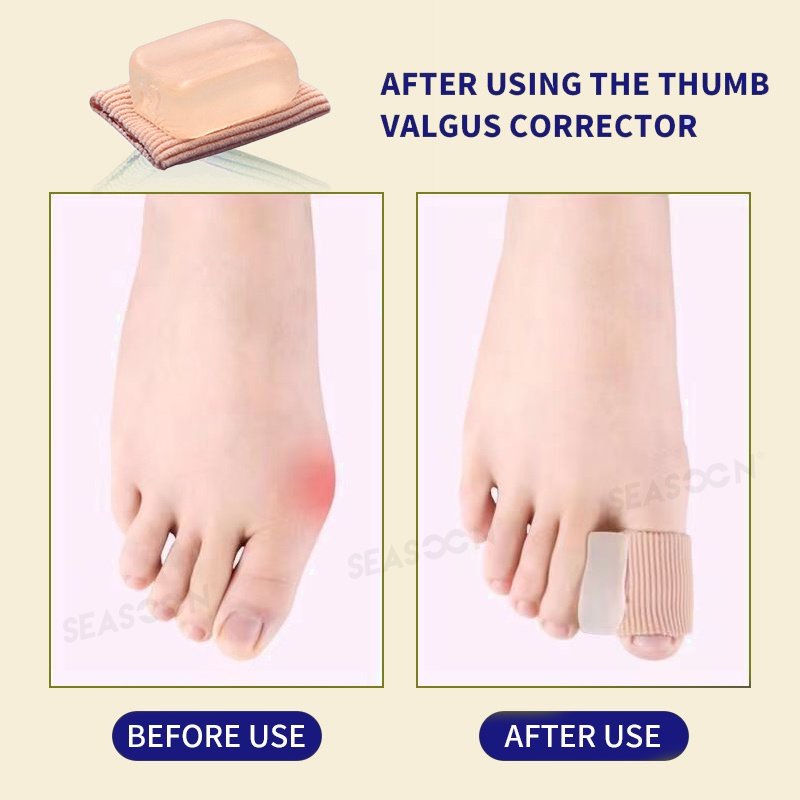 Big Toe Pelurus Jempol Dukungan Melindungi Gel Toe Toe Separator Bunion Korektor 1 Pc