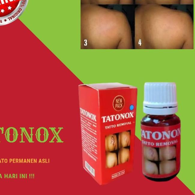 ☀ TATONOX ASLI / PENGHILANG TATO PERMANEN / PENGHILANG TATO ➸