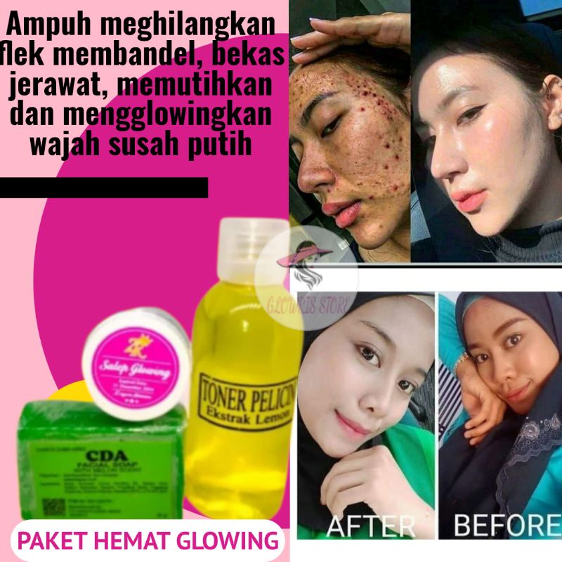 Paket Glowing Hemat Terlaris Ampuh 5 Hari Hilangkan Flek Hitam Membandel