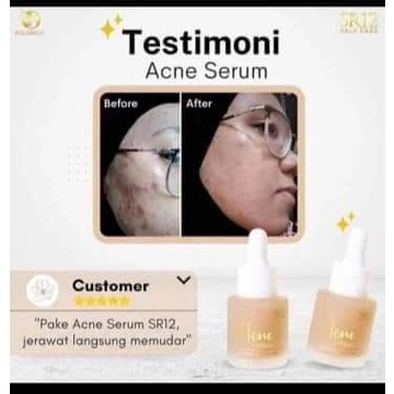 Acne Serum SR12 Serum Jerawat BPOM Ampuh Melawan Bakteri Penyebab Jerawat dan Mengecilkan Pori-pori