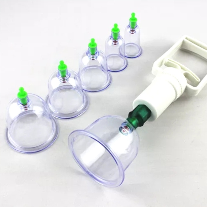 Kop Angin Bekam Alat Bekam Lengkap Kongsui Isi 6 Tabung - Alat Cop Masuk Angin Cupping Therapy Kit / Mengobati Masuk Angin