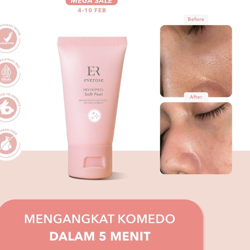 ► Everose Invisipeel Soft Peel Essential Series ➹