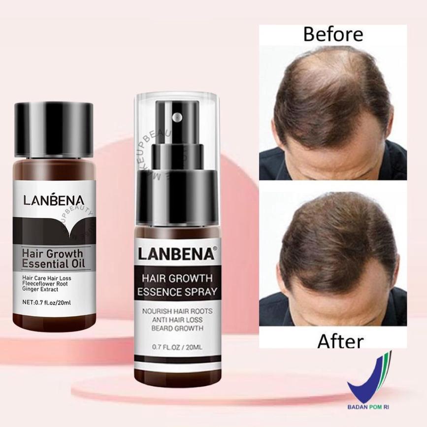 ❋ [] LANBENA Hair Growth Essential Oil 20ml | Essence Spray 20ml - Mencegah Kerontokan ♥