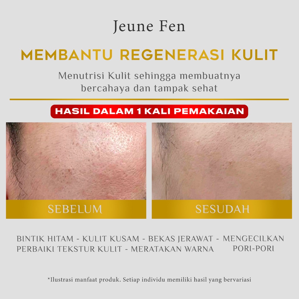 100% ORIGINAL!!!! BPOM JEUNE FEN FLAWLESS BRIGHTENING AND GLOWING SHEET MASK MASKER WAJAH MENCERAHKAN MEMUTIHKAN